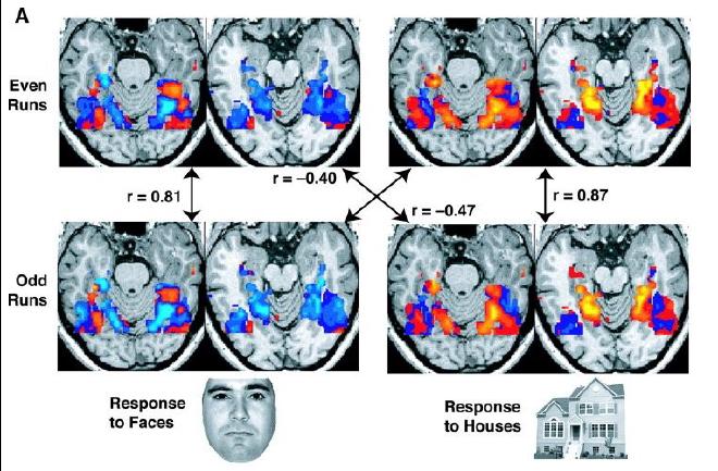 Taken straight from the wikipedia page for fMRI (public domain - National Institute of Mental Health)